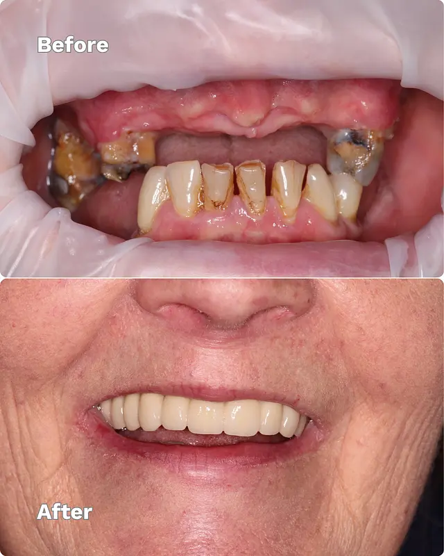 RDent Before After Template (9)