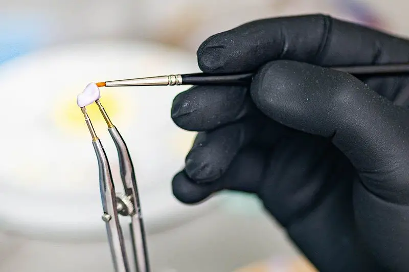 Dental Crowns – All You Need to Know