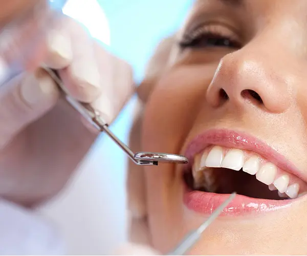 Teeth whitening