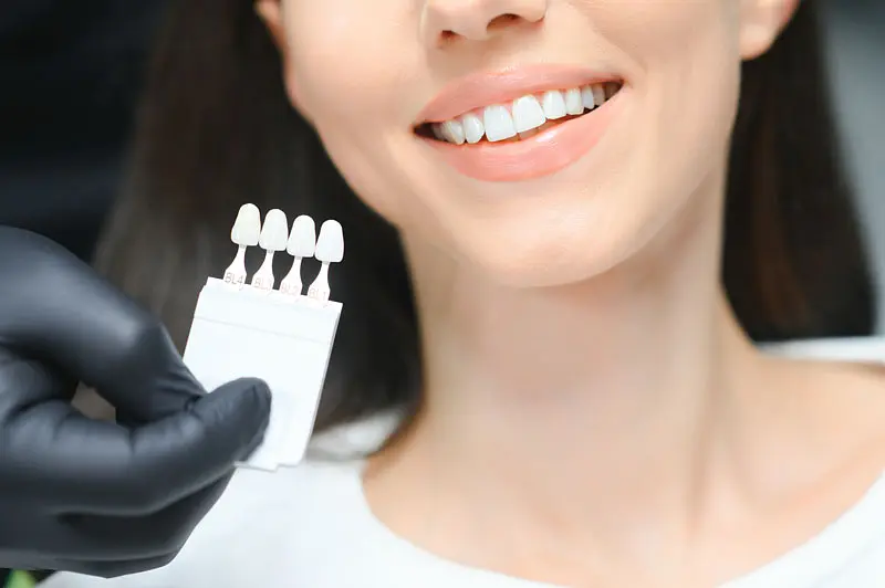 Composite Bonding