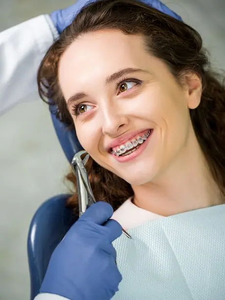 Professional Dental Services - Dental4U Clinic - Braces