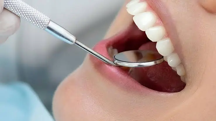 Dental crowns treatment at OB Dental in Limerick