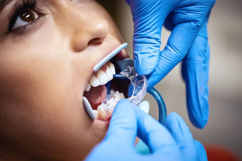 Orthodontic Dental Treatments