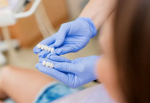 dental bridges cork city dentist M - Cork City Dentist