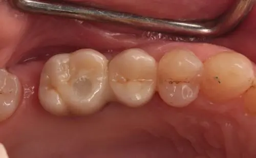 After -Harcourt Dental Clinic