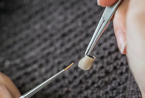 dental crowns cork